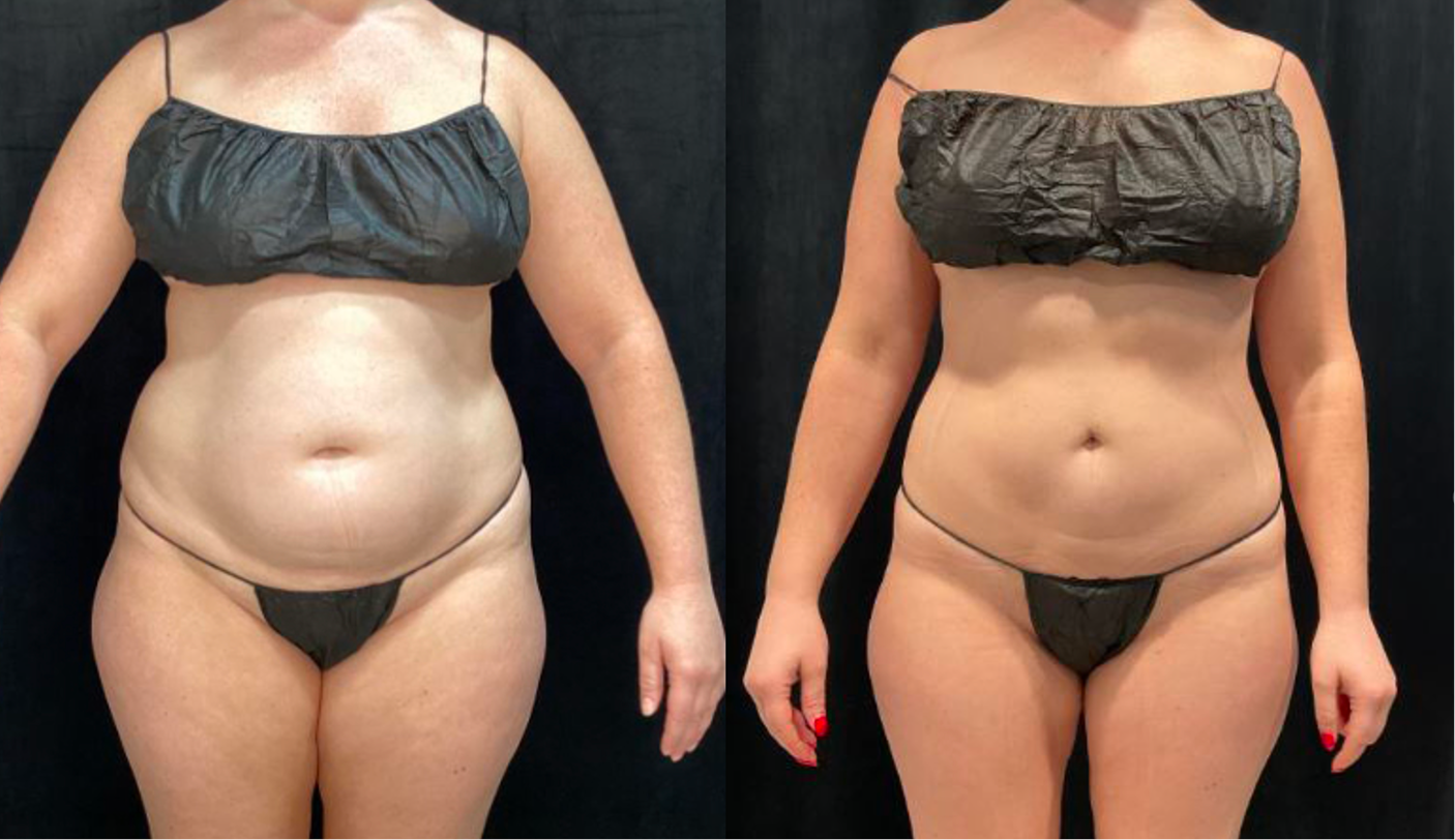niwabeforeafter2