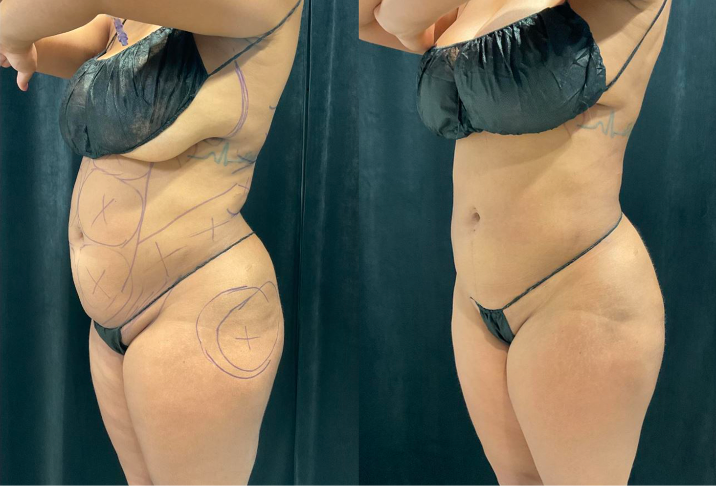 niwabeforeafter4